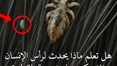 هل تعلم ماذا يحدث لرأس الإنسان إذا سكنت في ..شعره قملة لمدة شهر كامل دون أن يتخلص منها ؟؟