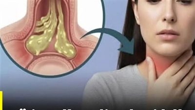 البلغم وعلاجه