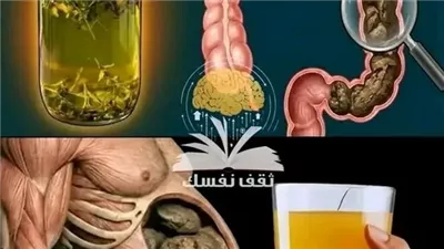 تنظيف القالون