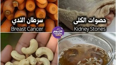 جلد الدجاج يسبب حصوات الكلى