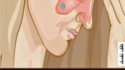 علاج التهاب الجيوب الأنفية ووقف احتقانها بـ10 وصفات تساعدك على تخفيف الصداع ومشاكل الجيوب الأنفية