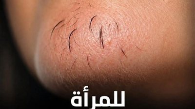 اذا كنتِ امرأة تعاني من شعر الذقن, انتبهي أليكِ ما يعتيه هذا, وكما احضرنا لك اسرع طـ.ـريقة للتخلـ.ـص منه نهـ.ـائي 