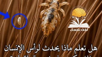 هل تعلم ماذا يحدث لرأس الإنسان إذا سكنت في شعره قملة لمدة شهر كامل دون أن يتخلص منها؟