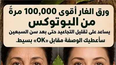 سحر الغار 2026.. كيف تعيد هذه الأوراق بناء الكولاجين وتشد البشرة مهما مر الزمن؟