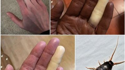 مليون مرة قبل ملامسة هذه الحشرة