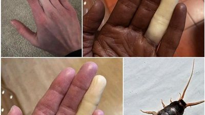 احذر مليون مرة قبل ملامسة هذه الحشره
