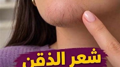  اذا كنتِ امرأة تعاني من شعر الذقن, انتبهي أليكِ ما يعتيه هذا, وكما احضرنا لك اسرع طـريقة للتخلـص منه نهـائي