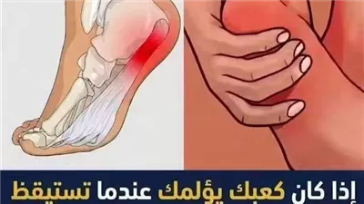الم كعب القدم عند الاستيقاظ