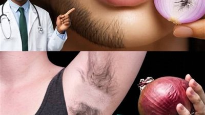 وصفات البصل لازالة شعر الوجه والجسم