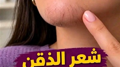 اذا كنتي تعـاني من ظهور شعر الذقن انتبهي أليكِ ما يعتيه هذا وايضا احضرنا لك اسـرع طــريقة للتخلــص منه نهــائي