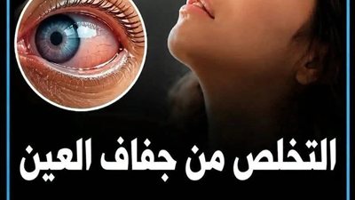 علااج جفاف العين بدون أدوية طـرق مجـربة تطبيقها بسهولة لتحافظ على العين عن طـريق اتباع بعض الوصـفات المنزلية