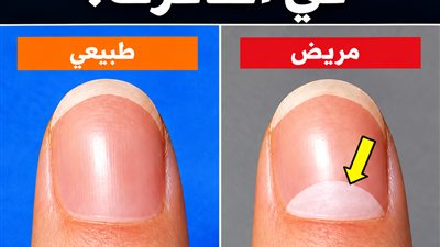 هل لاحظت القوس الأبيض في أظافرك؟ إليك ما الذي يعنيه فعلًا
