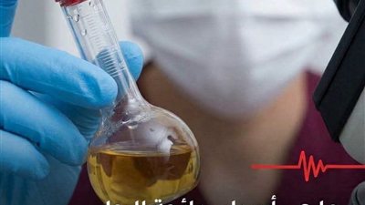 اعراض حصوات المرارة عند النساء وطرق العلاجات